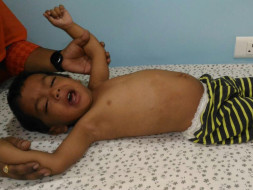 Help 2-year-old Baby Boy Riyansh fight a severe liver disease