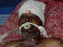 Help Sankar Recover From Road Accident