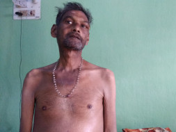 Help Him To Fight Against Liver Disease