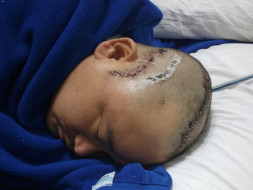 Help Dharma Lepcha Fight For His Life