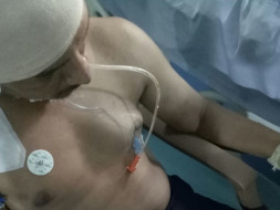 Help Rahul for Fight Battle Against Death Due to the Road Accident
