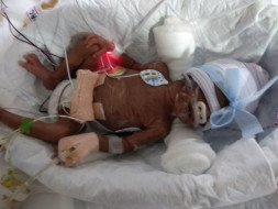 Help PrematureTwins who are now in the ICU fighting for their lives