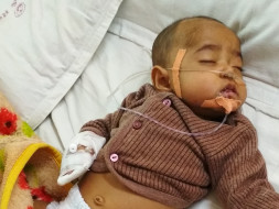 Fund Raising for Heart Surgery for 6 month Baby Boy