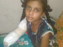 Help Helen (Her hands got amputated in a Electric shock)