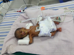 Father of a Premature Baby Sold All He Had To Try And Save His Baby