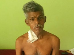 Help Vanamoorthy to fight chronic kidney disease