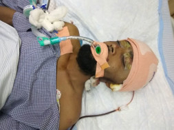 Help Rashmi Ranjan Nayak Recover From His Accident