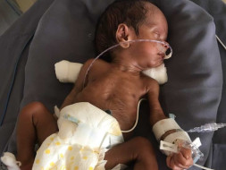 These Parents Need Your Help To Save Their Prematurely Born Baby Boy