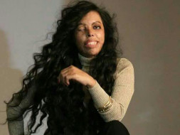An Event to Create Platform For Acid Attack Women