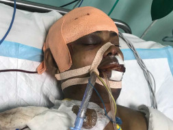 Bobby is looking to support his brain surgery bills