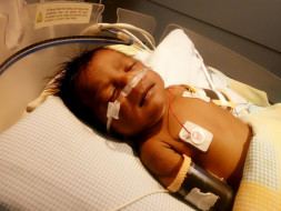 This 1-month-old's Heart Will Stop Beating Without An Urgent Surgery