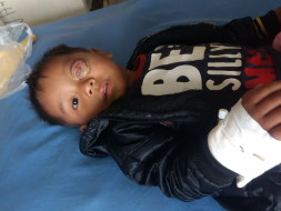 Baby Keffrien's Eye Has Been Ravaged By Cancer, Save His Life