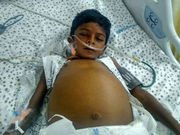 8-year-old Pawan Needs A Liver Transplant In Five Days To Live