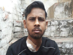 Need Kidney transplantation for My son Suraj