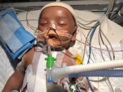 1.5 Month old Mohammed Ahil has to urgently undergo a cardiac surgery