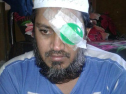 Ali is at the risk of completely losing his eyesight.