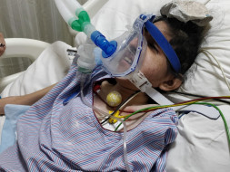 Urgent Funds Needed For Our Angel Kajal - Cerebral Palsy Child