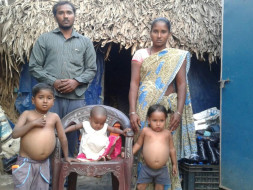Help These Little Warriors Who Are Fighting With Liver Damage