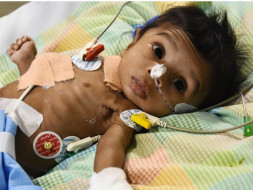 Help 9-month-old Elisha Who Has Lost 90% Of Her Small Intestine