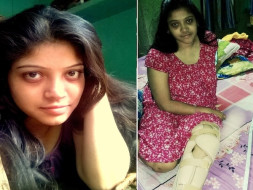 Help Nabanita to Walk Again