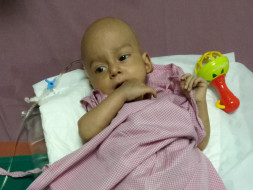 Help Shoaib fight Tumor - (Age: 1 year now)