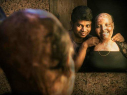 In the name of love for acid attack survivor Rani