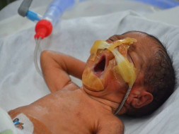 Twins Born After 26 Years Of Marriage Are Now Fighting To Survive