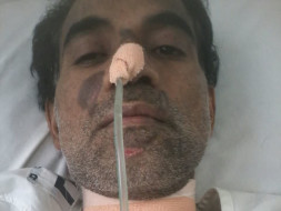 Help alfred lobo from Brain stroke