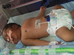 Save New Born Child Of Sankar Ramajayam Having Cardiac Issues