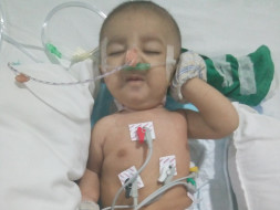 Help This 3-Month-Old Baby Who Is Fighting For His Life In The ICU