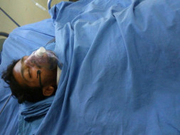 Save My Friend Rupesh Muthyala With Your Generous Donations