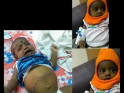 Help This 5 Month Old Fight Liver With Liver Failure