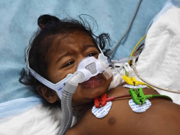 Help 11-month-old Kabelish Fight Pneumonia And Breathe Again