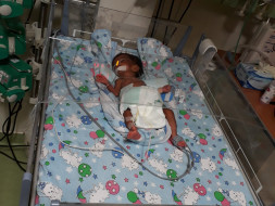 Help For Nicu Neonatal Icu Charges Of My 28 Weeks Premature Baby Girl