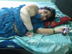 Bolster Syamala's health by backing her who suffering withLIVER CANCER