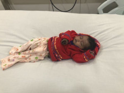 Help 3-month-old Gunjan fight a severe heart disease