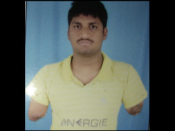 Help Srini To Have His Hands Transplanted