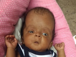Help Baby Deepidi having blockage in one nerve in head