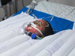 50% Of This Baby’s Body Is Burnt And He’s Struggling To Live