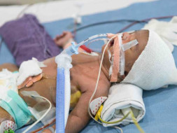 "My 2-week-old Baby Is Fighting To Stay Alive After A Heart Surgery"