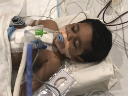 Help 1-year-old Pari fight a severe heart disease