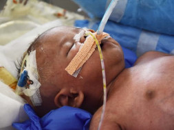 Help Ambika save her premature baby