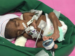 My 3-Week Old Lost Her Twin Brother, Help Us Save Her Now