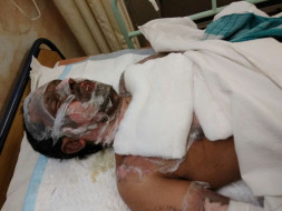 Help Pradeep Nayak(29 Yr) To Fight The Battle For His Life