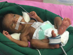 Priyanka Premature Babies Are Struggling To Live In The ICU