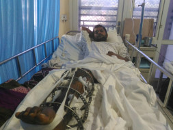 Cancer affected leg broken into pieces.