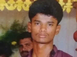 Help Hariprasath Skull Operation