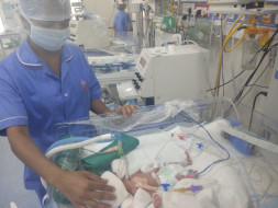 Help Premature Quadruplets 26 week undergone treatment for survival