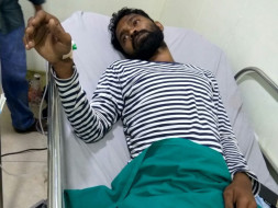 Help My Colleague Who Needs Heart & Lungs Transplantation