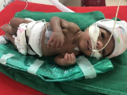 Help Vishakha and Vinayak save their premature baby boy